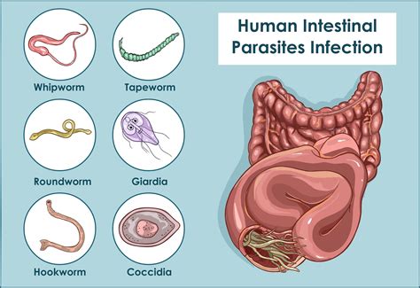  Dientamoeba! Um Parasita Intrincado que habita o Intestino Humano e Causa Infecções Gastrointestinais