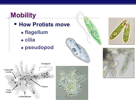 Heterotrichia: Um Protista Intrigante que Mistura a Vida Sésil e Móvel!