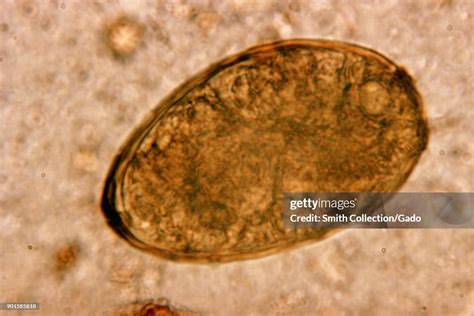 Paragonimus! Um Parasita Trematode de Peixe que Constrói Casas em seus Pulmões